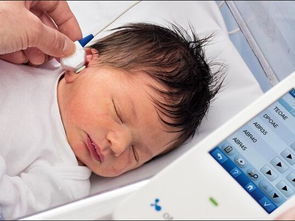 新生儿听力检测时机